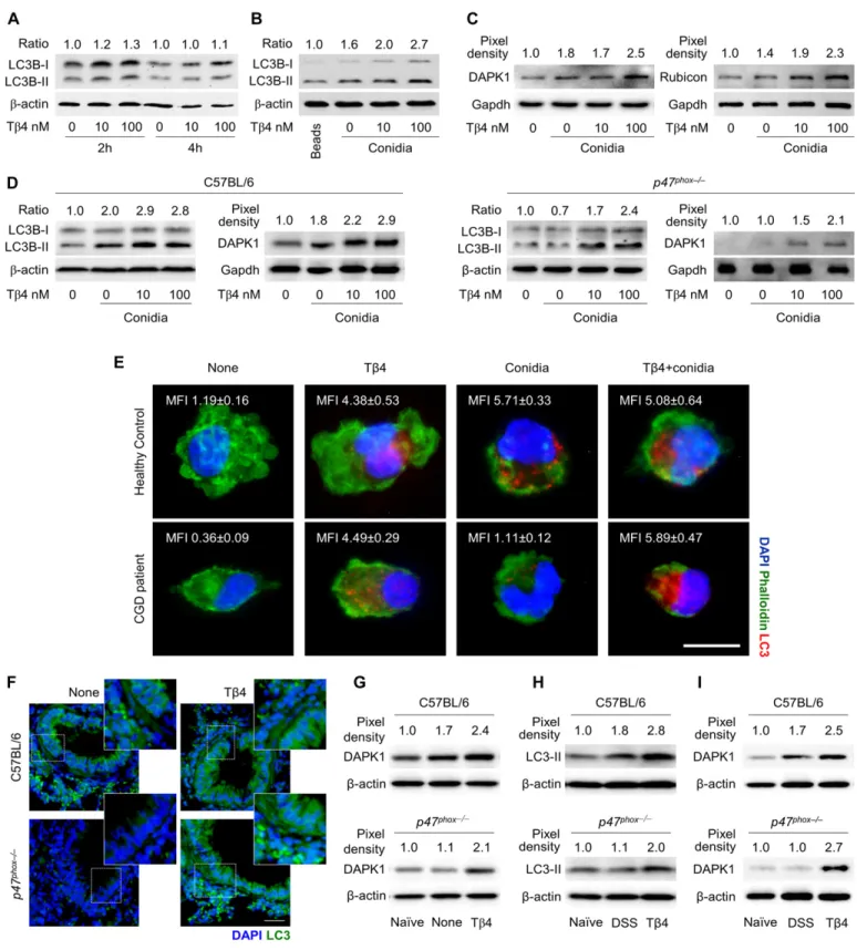 Figure 1. T β4 promotes LC3-associated phagocytosis involving DAPK1.