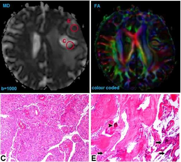 Fig. 3. Mγ, Mα and the conventional MD map obtained from the controlled phantom illustrated in Fig