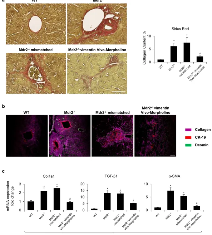 Fig. 3. Vimentin Morpholino treatment decreases liver ﬁbrosis. [a] Measurement of collagen deposition by Sirius Red staining in liver sections