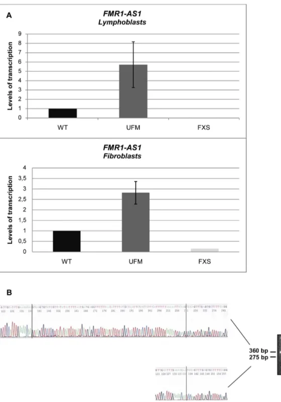Figure 1. Characterization of FMR1-AS1 transcript in UFM cell lines. (A) Quantification of antisense transcript through RT-PCR in WT, UFM and FXS lymphoblasts (n = 5) and fibroblasts (n = 4)