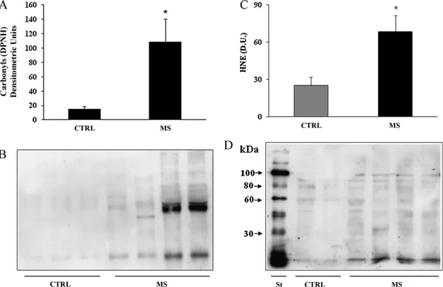 Fig. 3. Protein carbonyls and HNE (4-hydroxy-2-nonenals) levels in the CSF of MS patients