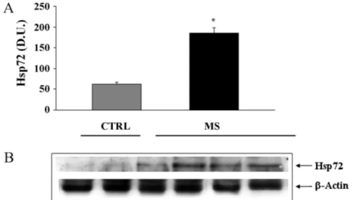 Fig. 5. (A) Heat shock protein 72 (Hsp72) levels in multiple sclerosis patients.