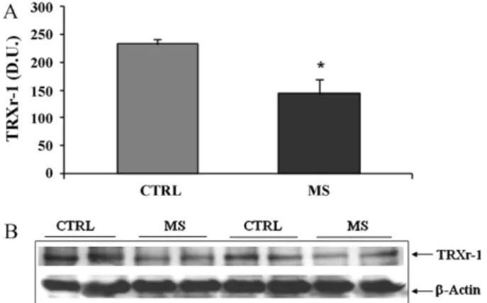 Fig. 10. (A) Protein carbonyls (DPNH) and (C) HNE levels in lymphocytes from multiple sclerosis and control patients