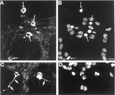 Figure 7. Ubiquitin immunostaining in cerebellar granule neurons un- un-dergoing apoptosis analyzed by confocal microscopy
