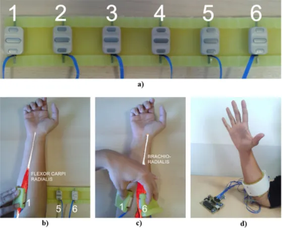 Fig. 1. Silicone support bracelet with six sEMG sensors (a) and its placing around the forearm (b–d).