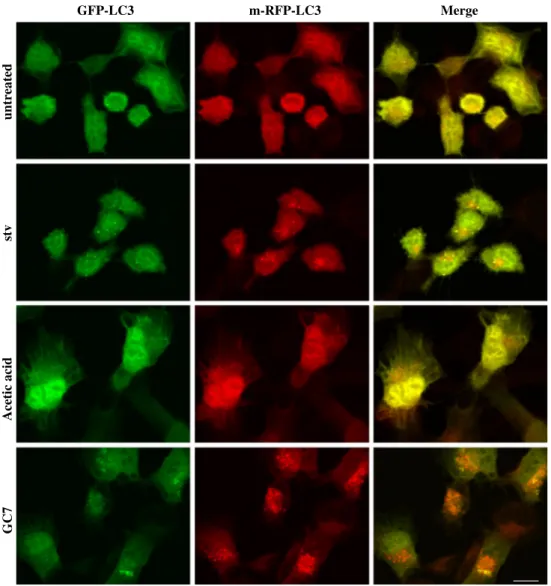 Fig. 3   GC7 does not affect the  autophagic flux.  Representa-tive fluorescent micrographs of  2F cells stably expressing an  RFP-GFP-LC3 recombinant  protein