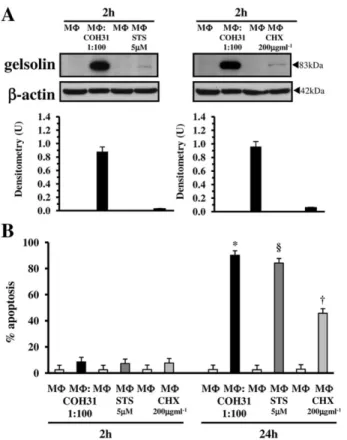 Fig. 11. Effect of two different M Φ apoptotic stimuli on gelsolin increase and apoptosis.
