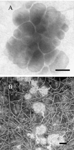 Fig. 7. TEM images of NaPAA – DOTAP complexes at charge ratio N  / N + = 0.65, at moderate polyion concentration (concentration marked by the letter b) in the panel B of Fig