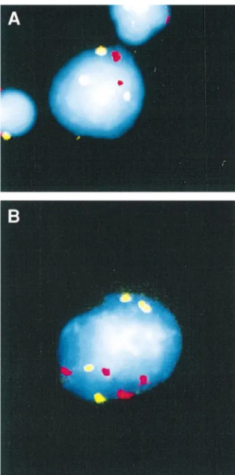 Fig. 4. Frequency of interphase nuclei with three hybridization signals for either chromosome 7 or 11 in human lymphocytes treated in vitro with low concentrations of colchicine in the presence and absence of cyt B.