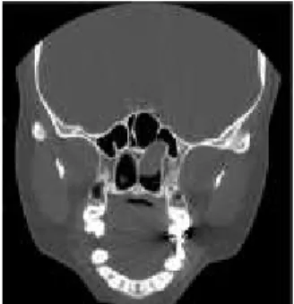 Figure 1 CT image