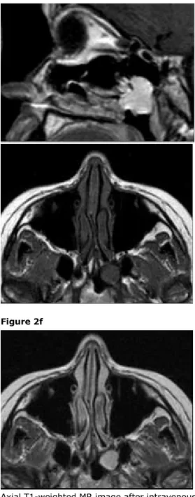 Figure 2f Figure 3 Endoscopic images Figure 3a Figure 3b Figure 3c Figure 3d Figure 4