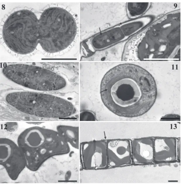 Figs 8 –13. TEM micrographs of the main phototrophs found in cultured phototrophic bioﬁlms