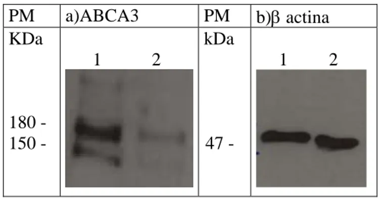 Figura 16: Western Blot. 