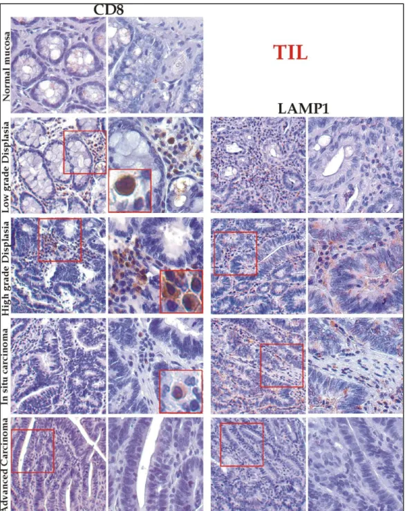Figure 16. Immunohistochemical analysis of TIL infiltrates during rat    colorectal carcinogenesis process