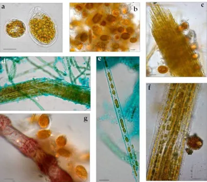 Figure 2. Light micrographs of July bloom communities washed off briozoa, Ostreopsis cf