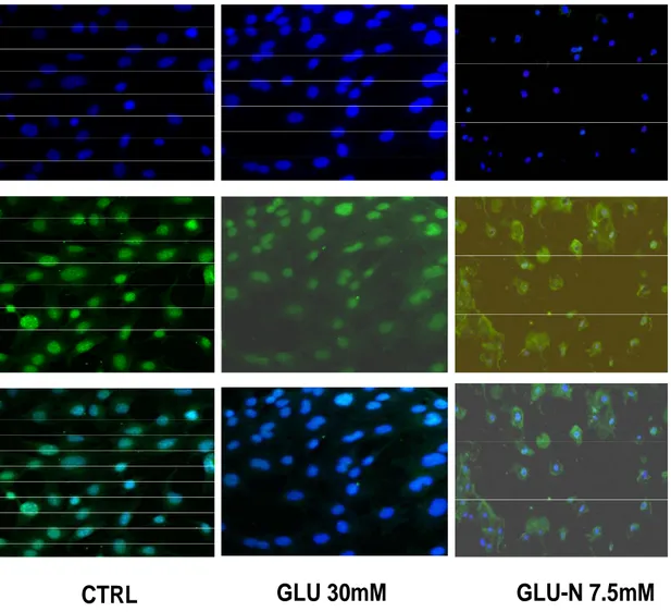 Figura 16 Immunofluorescenza su Hep WT: 4x10 5  cellule differenziate  incubate con  anticorpo anti HMGB1 marcato con AlexaFluor 488(  verde) ed Hoechest 33342 ( blu) per  identificare i nuclei; la traslocazione è valutabile nel riquadro merge