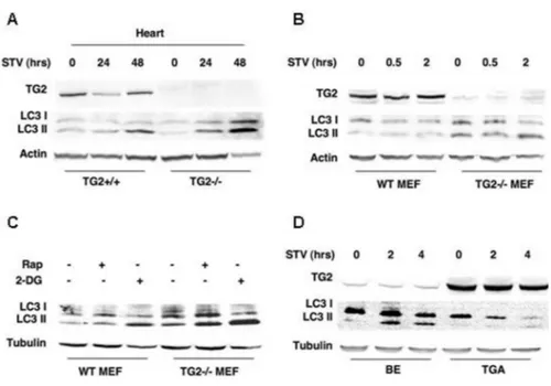Figure  6.  TG2  modulates  the  expression  of  autophagy-associated  proteins  LC3.  (A)  Myocardium  tissue  fragments  were  removed  from  WT  and  TG2 -/-   mice  under  resting  conditions as well as after 24-48 h of starvation (STV) and then homoge