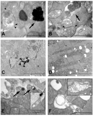 Figure 7. Transmission electron micrographs of hearts  taken from  WT (A, C  and E) and  TG2 -/-  (B,  D  and  F)  mice,  housed  under  starvation  conditions  for  48  h
