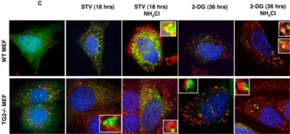 Figure 11. Immunofluorescence analysis of autophagy in TG2 -/-  vs. WT MEFs. Formation  of autophagic structures in WT and TG2 -/-  MEFs undergoing autophagy in the presence and in  the absence of NH 4 Cl, which inhibits the activation of the lysosomal enz