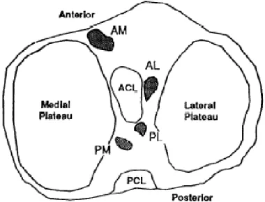 Fig. 1   : Immagine assiale del piatto tibiale destro che  mette in evidenza l’inserzione delle corna meniscali