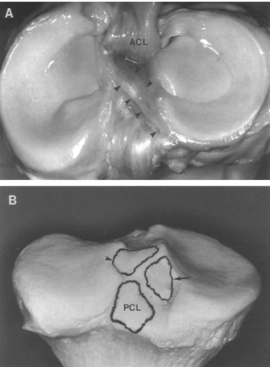 Fig. 4 : A. corno posteriore del menisco esterno e legamento crociato  anteriore. B. superficie d’inserzione del corno posteriore del menisco  laterale (freccia), superficie d’inserzione del legamento crociato 