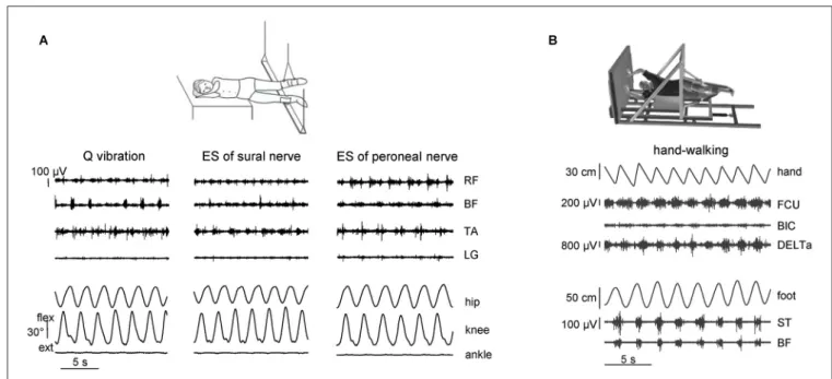 FIGURE 1 | Eliciting non-voluntary limb stepping movements in simulated weightlessness (gravity neutral) conditions