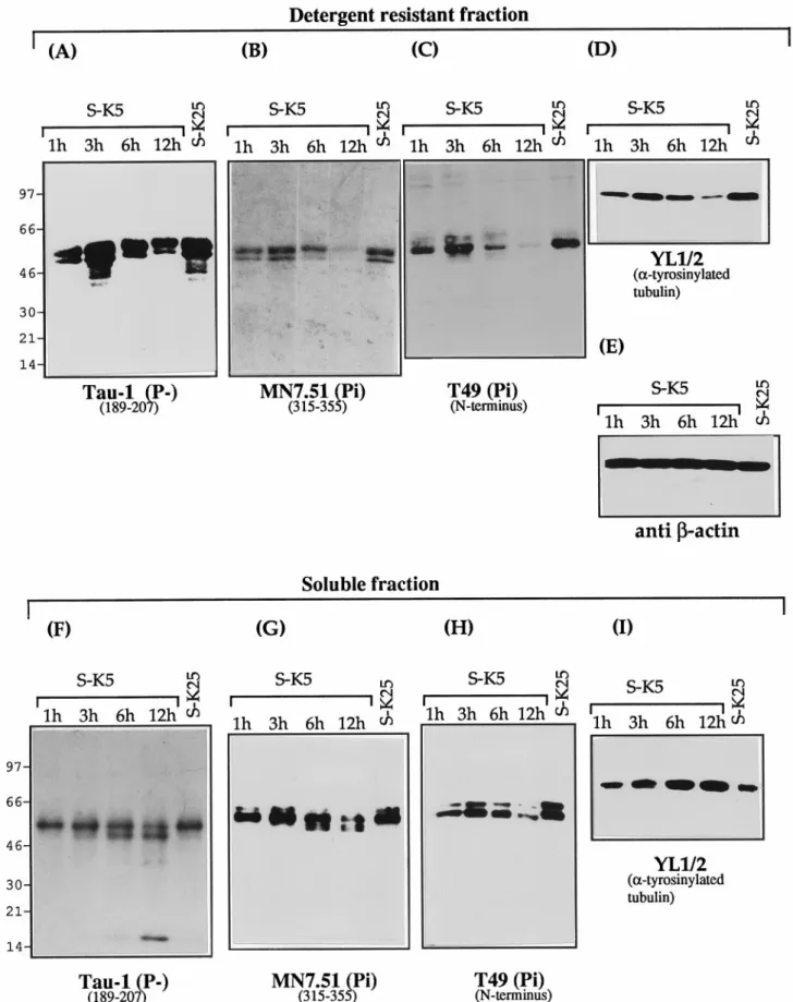 Figure 3. The 17 kDa fragment is unable to bind to microtubules: disassembly of the microtubule network during apoptosis