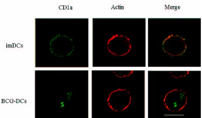 Figure  6.  Confocal  laser-scanning  microscopy  (CLSM)  analyses  of  localization  of  CD1a  molecules  in  DCs  derived  from  untreated  (imDCs)  or  BCG-infected  (BCG-DCs)  monocytes