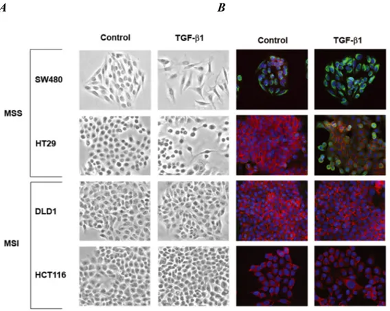 Figure  1.  A  and  B,  Phase  contrast  photomicrographs  and  immunofluorescence  images  of  control cells and cells treated with 5ng/mL TGF-β1 for 48 hours