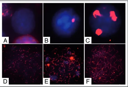 Figure 2. Pattern of SCP3 organization in male germ cells from 7 dpn mice. Representative  merged  immunofluorescence  images  showing  SCP3  (red)  organization  on  nuclear  spreads  (blue)  in  (A)  undifferentiated  spermatogonia,  (B)  differentiating