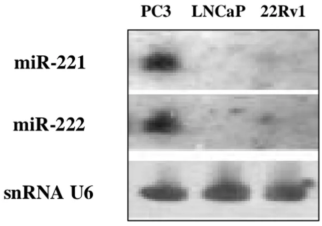 Figura  1.  Analisi  di  espressione  per  Northern  blot  dei  miR-221  e  2222  in  linee  cellulari  di  carcinoma  di 