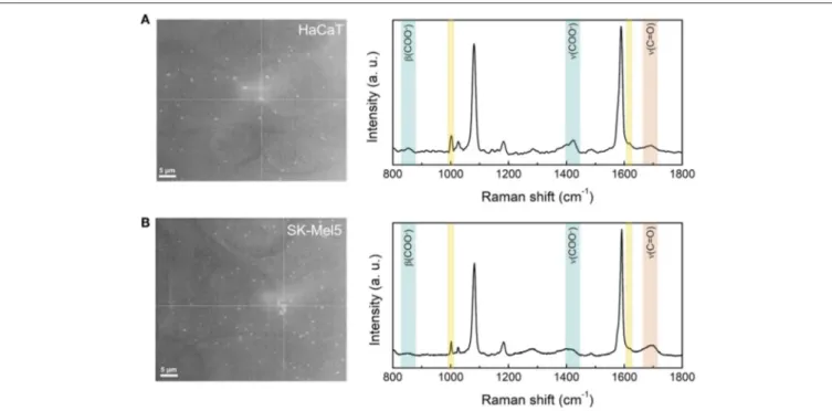 FIGURE 6 | Optical microscope images and SERS spectra of HaCaT (A) and SK-Mel5 (B) cells exposed to the nanosensor