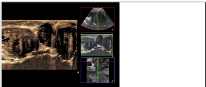 Figure 1 Ultrasonography