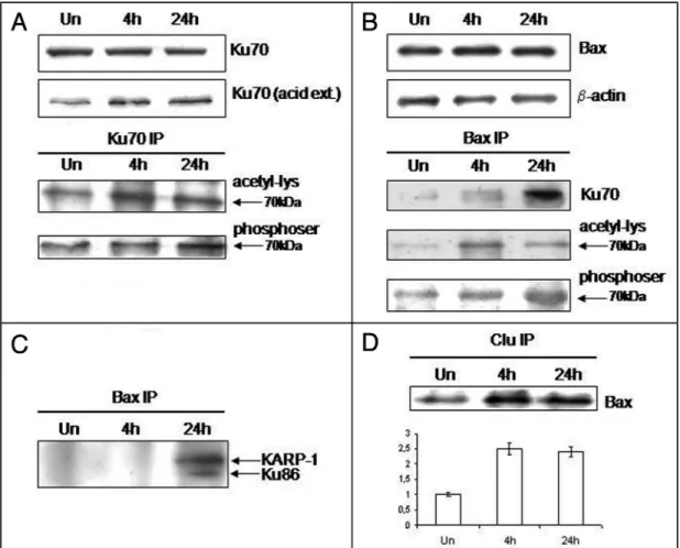 Figure 2. IL-6 influences Bax-Ku70 interaction. Ku70 and Bax protein levels in the cytoplasmic fraction of untreated (Un) and IL-6 treated Caco2 cells (A and B)