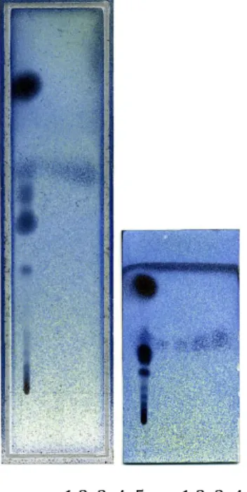 Fig.	
   15:	
   cromatografia	
   OPLC	
   (a)	
   e	
   TLC	
   (b)	
   di	
   olio	
   essenziale	
   di	
   finocchio	
   (pozz	
   1)	
   e	
   soluzioni	
   di	
   fenchone	
   a	
   concentrazione	
  crescente	
  (1,23	
  –	
  2,46	
  –	
  6,15	
  –