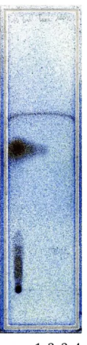 Fig.	
  16:	
  cromatografia	
  OPLC	
  di	
  olio	
  essenziale	
  di	
  finocchio	
  (pozz	
  1)	
  a	
  confonto	
  anetolo	
  e	
  fenchone,	
  come	
  in	
  fig.	
  