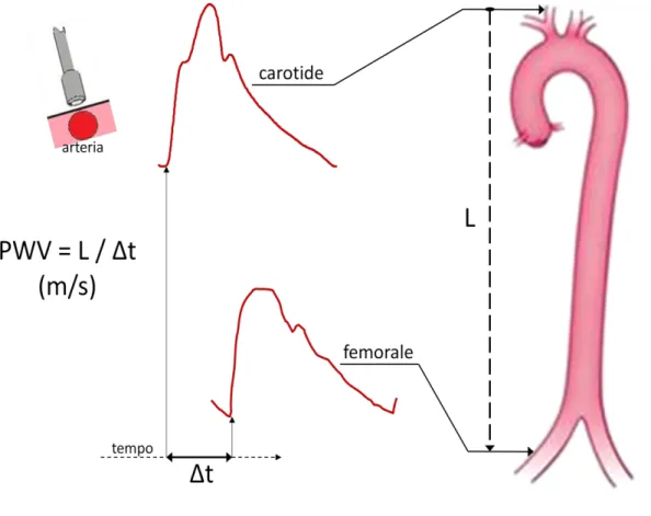 Figura 3. Pulse Wave Velocity carotido-femorale. 