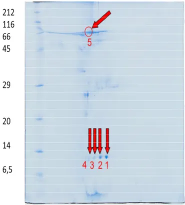 Fig. 19: SDS-PAGE 12% di ultrafiltrato, membrana Poly210, le frecce indicano gli spots identificati con la massa e le relative modifiche post-traduzionali: Spot 1 e 2→ β2-microglobulina (spot 1 forma fosforilata della proteina) Spot 5 →  sieroalbumina Spot