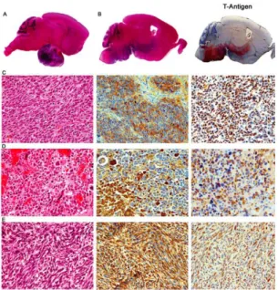 Figure  1.5.  JCV-induced  tumors  in  transgenic  animals.  (A)  The  brain  of  a  JCVCY  (archetype)  transgenic mouse with a large, extra-axial mass in  the  pituitary  region