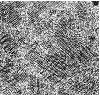 Figure  1.1.  Electron  micrography  of  JC  virions.  JC  virions,  uniform  in  bothsize  and  shape,  display   perfect alignment patterns called crystalloid arrays (Yukiko Shishido-Hara, Acta Neuropathol, 2010)