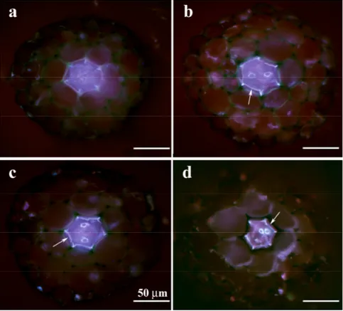 Fig. 10. Fresh hand-made cross sections of the roots of P. vittata, stained with berberine  and flour yellow, at about 3 mm from the apex: a) control root, b), c), d)  roots belonging  to plants treated for 5 days with 30, 60, 100 µM of CdCl 2  respectivel