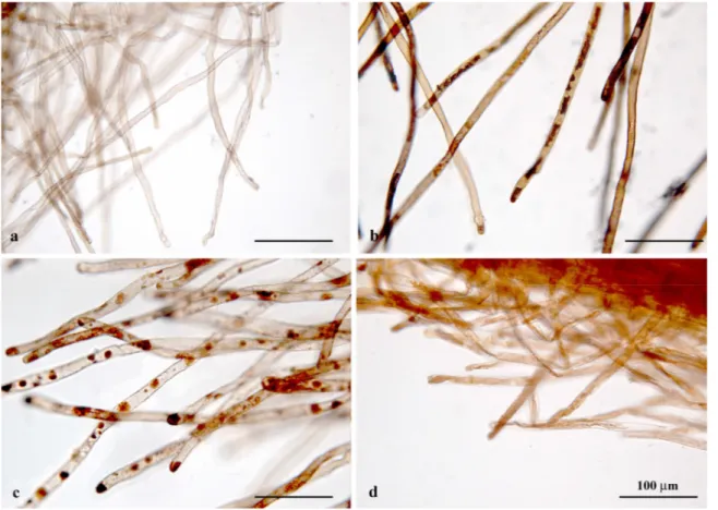 Fig. 14. Root hairs of P. vittata after treatment with dithizone: a) control  root, b), c), d)  roots hairs belonging to plants treated with 30, 60 and 100 µM Cd respectively