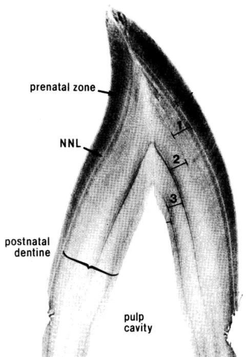 Figura 2.2 Sezione trasversale di un dente. Le età sono indicate dai numeri. (Hohn et al., 1989) 
