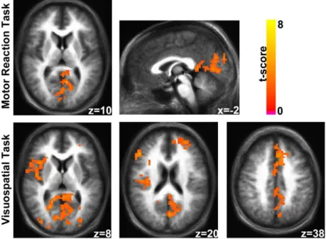 Fig.  6.  MSSD  Group  Comparisons.  MSSD  contrast  maps  for  MR  (a)  and  VS  (b)  task