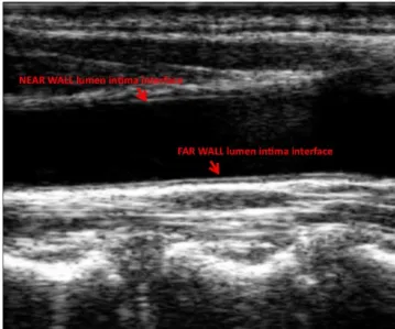 Figure 2. Ultrasound carotid longitudinal image 
