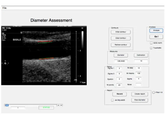 Figure 3. GUI for ultrasound image sequences analysis 