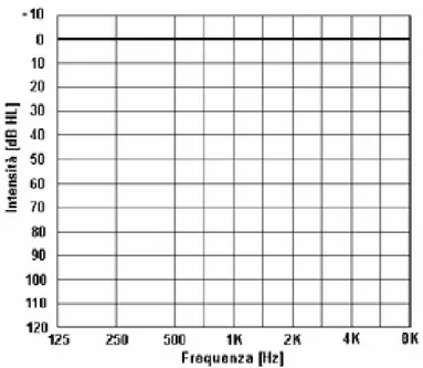 Figura 1.9 – Audiogramma. Sull’asse delle ascisse è riportata la frequenza, espressa in Hz,  su quello delle ordinate l’intensità, espressa in dB