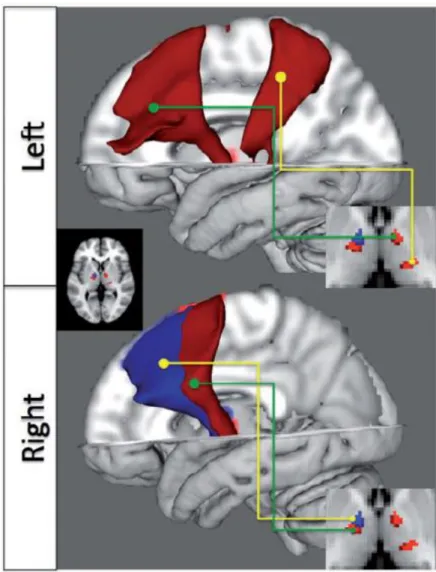 Figura  5.  Alterazioni  della  connettività  strutturale   talamo-corticale in pazienti JME