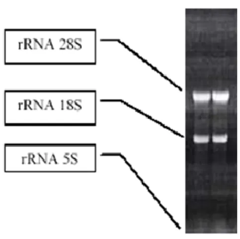 Figura 7: Corsa elettroforetica su gel di agarosio all’1% di rRNA 
