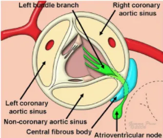 Fig.   7:   L'illustrazione   mostra   la  localizzazione   delle   fbre   di   conduzione  atrio-ventricolari,   come   vengono   viste   dal  chirurgo lungo l'aortic root